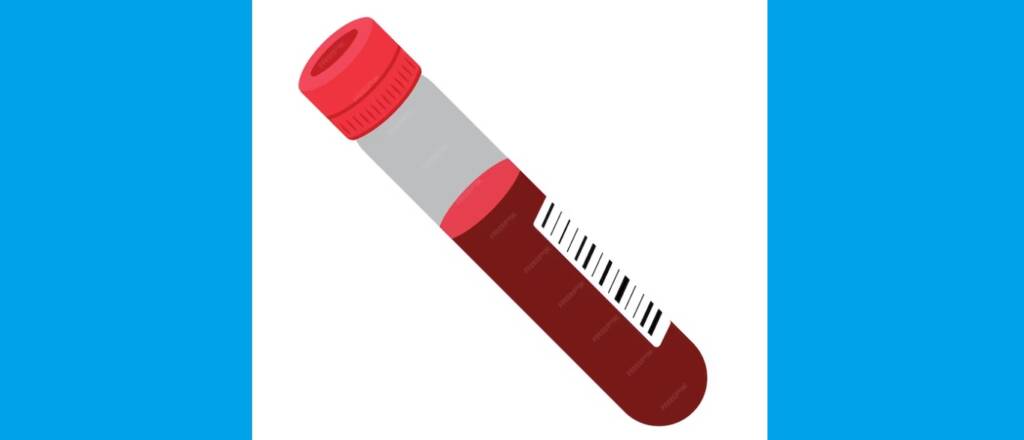 CBR alcohol keuring - Rijbewijsbelang