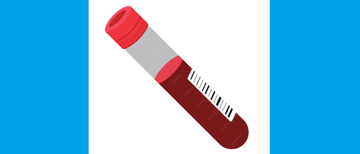 CBR alcohol keuring - Rijbewijsbelang